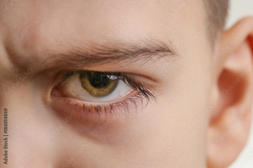 Close up view of a green boy's eye looking at camera Close up view of a green boy's eye looking at camera