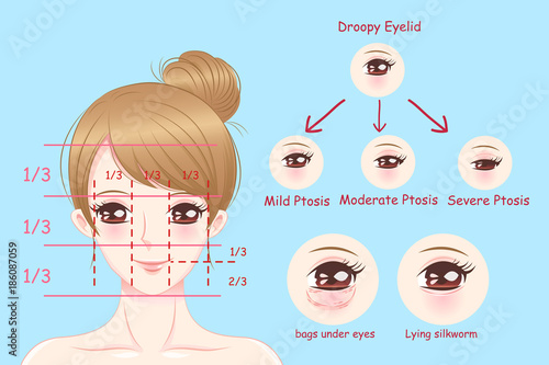 woman with droopy eyelids