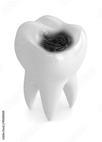Obraz na plátně 3d render of tooth with decay