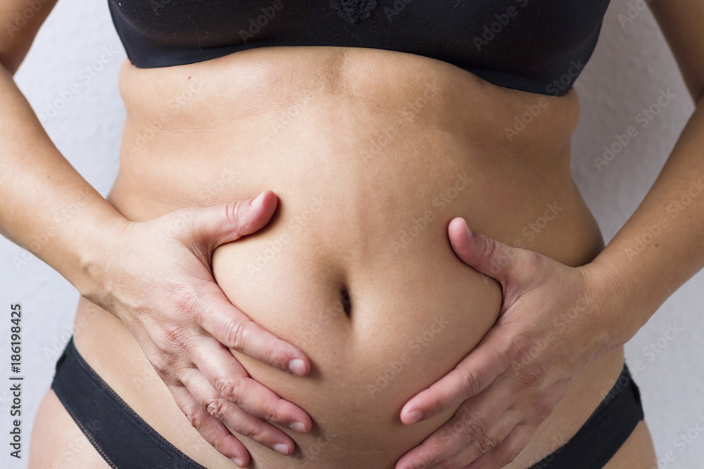 Woman's fat belly Woman's fat belly