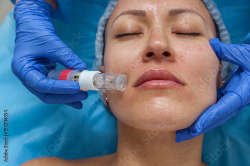 Cosmetic treatment by injection in the clinic. Use of a dermal injector to stimulate the skin. A woman receives injections of a placental-peptide serum