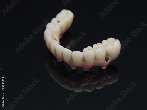 Complete lower prosthesis dental screwed over black glass.