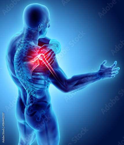 Foto Shoulder painful skeleton x-ray, 3D illustration.