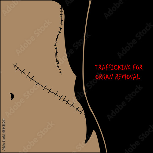 Human Trafficking Awareness Day, four type illustration of human trafficking in vector.