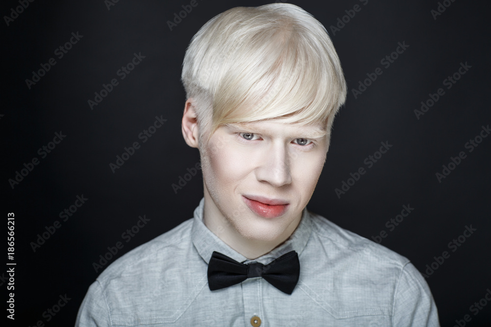 albino man white skin Stock Photo | Adobe Stock