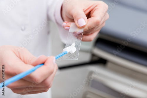 Gynecology consultation. Doctor taking analysis of Vaginal Smear 