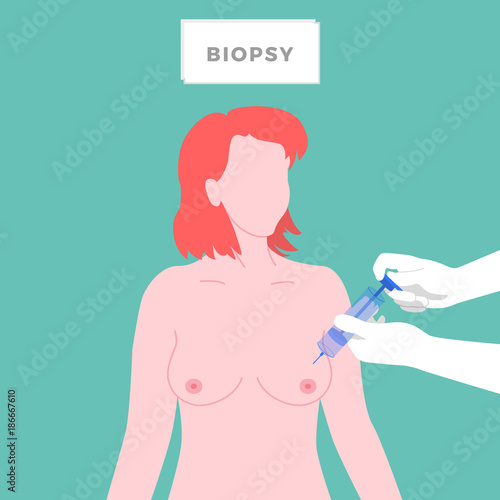 Breast Cancer Diagnostic. Biopsy. Medicine, pathology, anatomy, physiology, health. Vector illustration. Healthcare poster or banner template.

