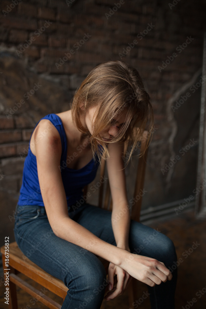 Sad woman victim of domestic violence and abuse sits on chair with bruises and wounds on her body.