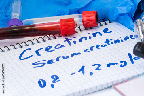 Creatinine or serum creatinine in basic metabolic test. Laboratory test tubes with blood, stethoscope, smear or film and gloves are near note with text creatinine on table in doctor office