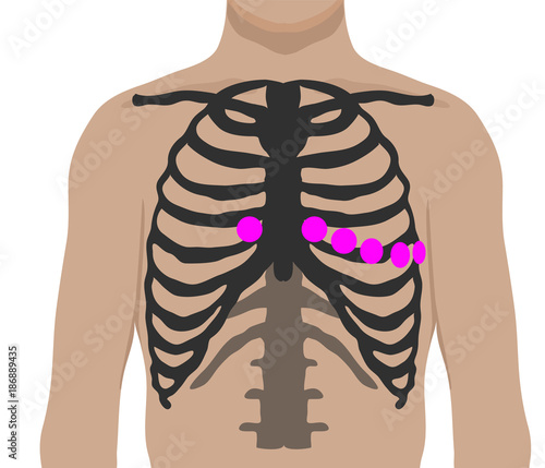 Chest leads placement. Ecg electrode position
