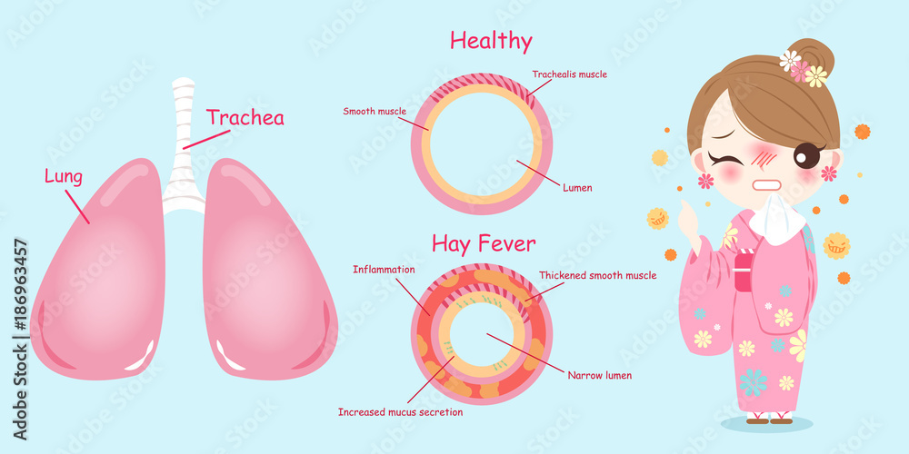woman with hay fever problem woman with hay fever problem