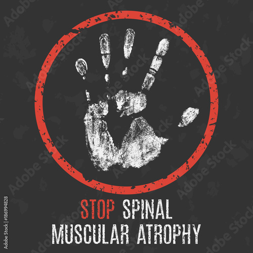 The medical diagnosis. Stop spinal muscular atrophy.