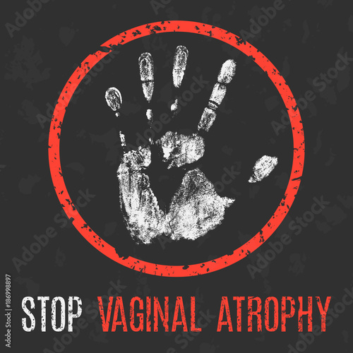 Vector illustration. Human sickness. Stop vaginal atrophy.