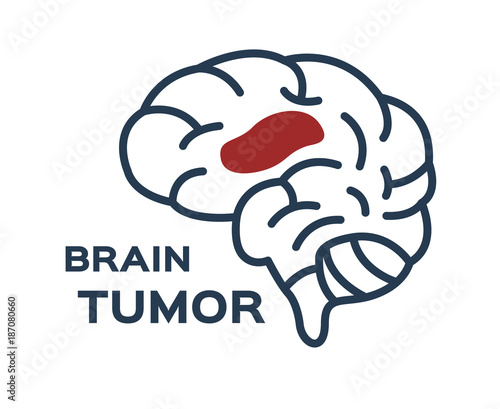 brain tumor vector icon