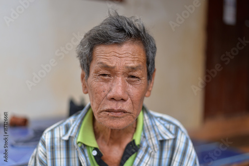 The old man has wrinkles on the face.