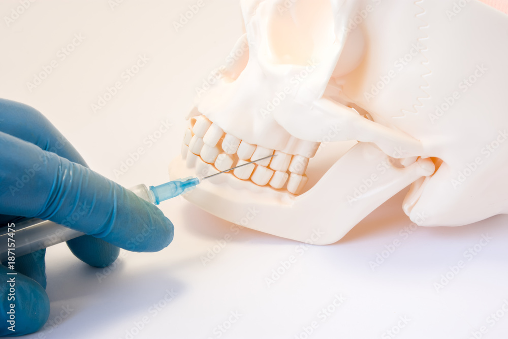 Dental anesthesia or puncture cyst tooth concept photo. Doctor dentist holding syringe, needle