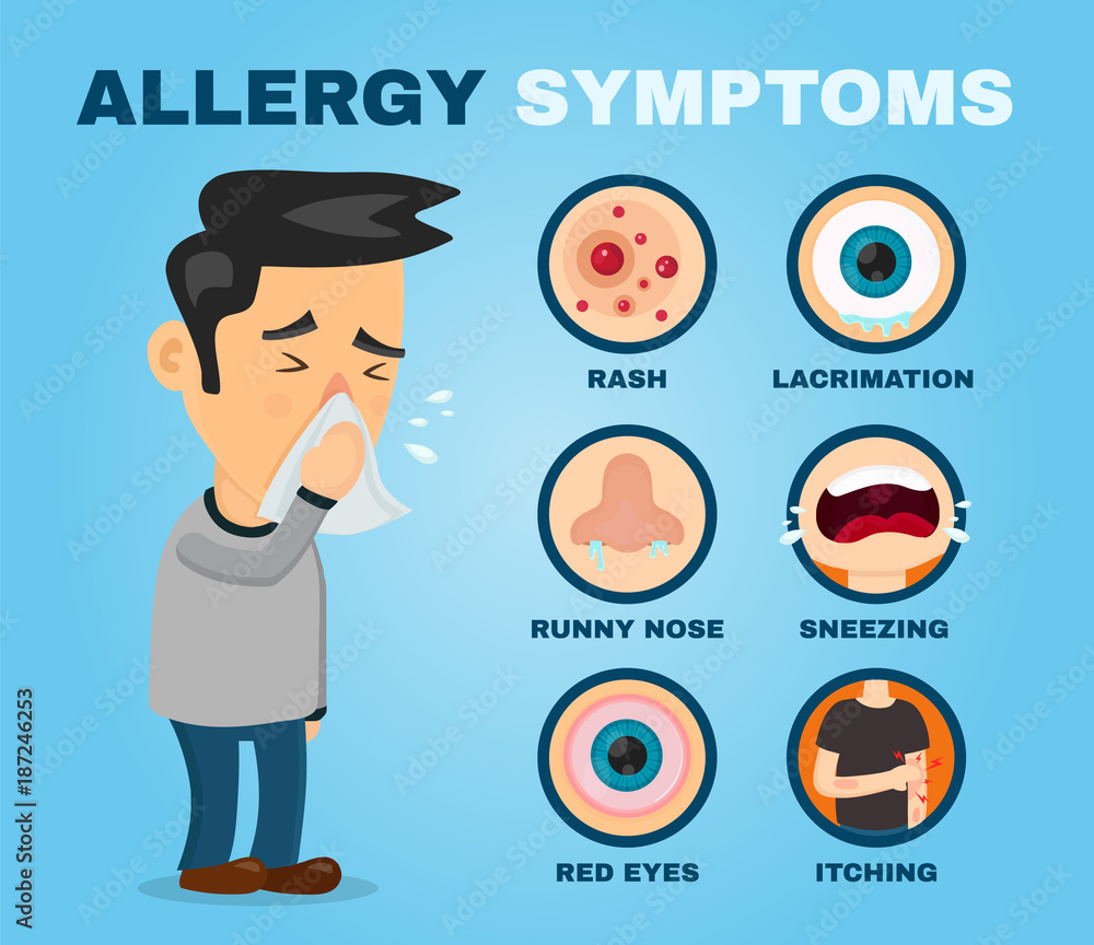 Allergy symptoms problem infographic vector