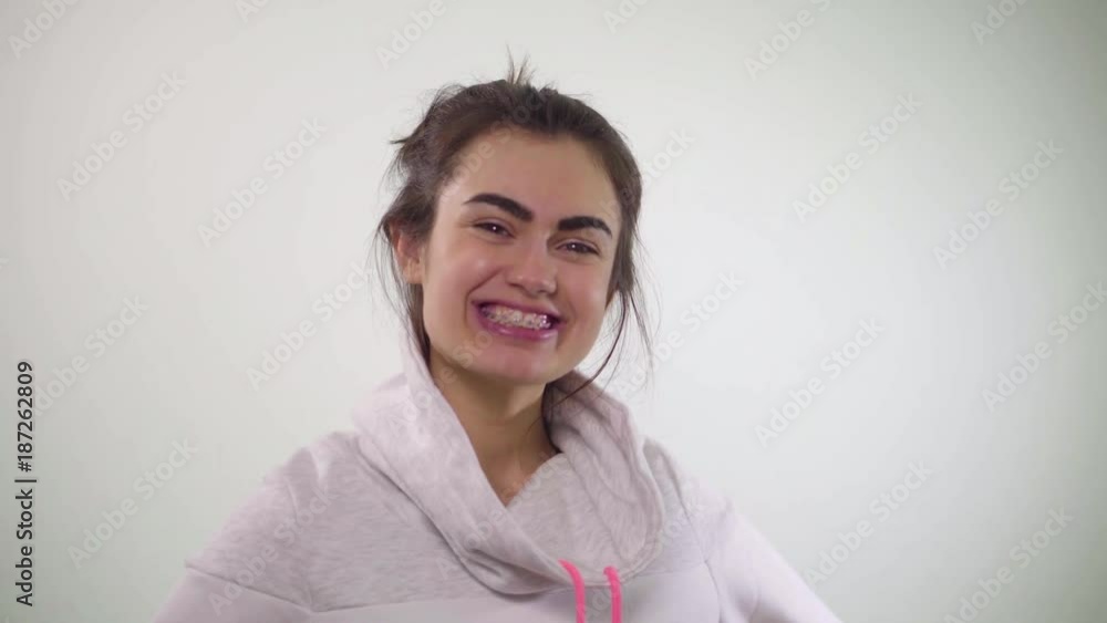 Girl hides braces with collar of hoodies and appears already without braces with perfect smile Girl hides braces with collar of hoodies and appears already without braces with perfect smile