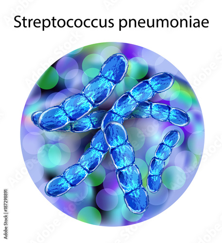 Streptococcus pneumoniae, or pneumococcus.