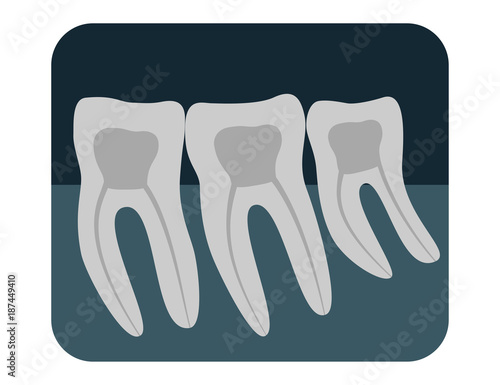 X-ray of human teeth. Three healthy molars on an x-ray. Vector illustration.