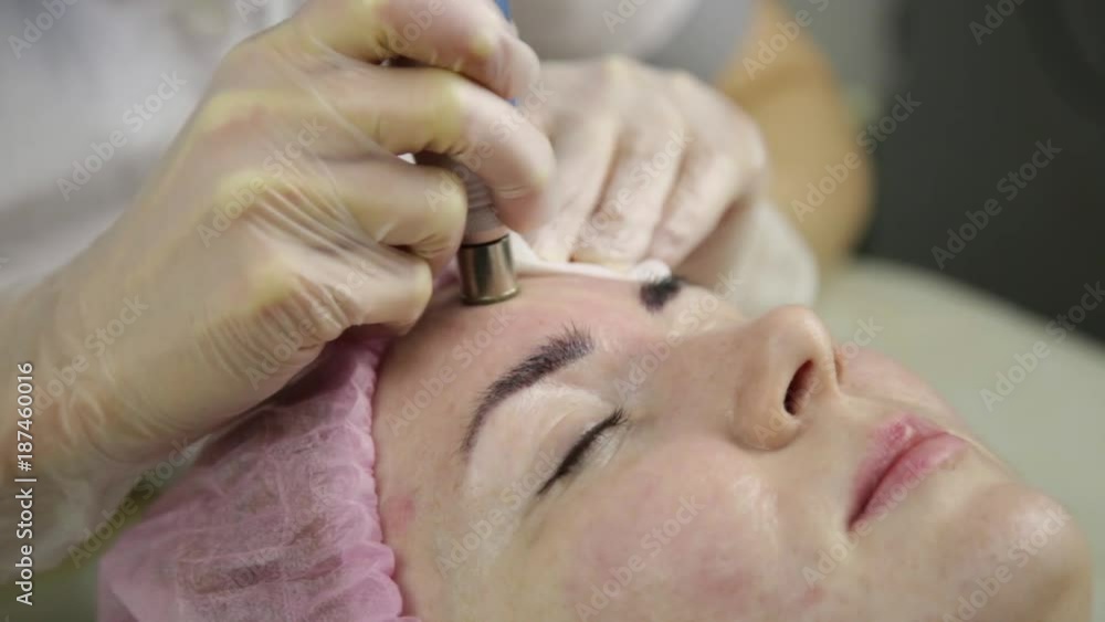 Young woman with problem skin getting a cosmetic procedures with medical equipment Young woman with problem skin getting a cosmetic procedures with medical equipment