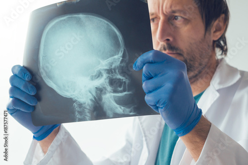 Doctor examining x-ray of the skull