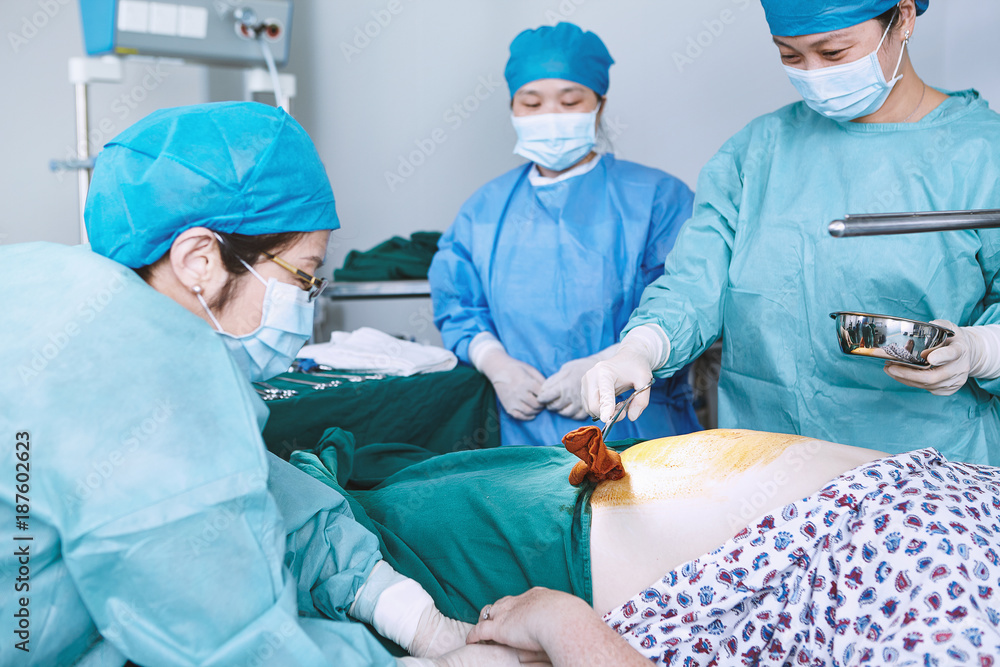 Surgeons swabbing patient abdomen in maternity ward operating theatre Surgeons swabbing patient abdomen in maternity ward operating theatre