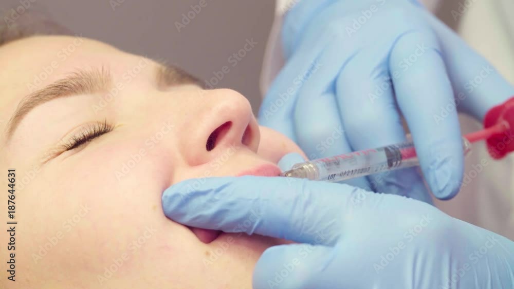 Lip injection plastic surgery. Close up face of patient during lip augmentation Lip injection plastic surgery. Close up face of patient during lip augmentation