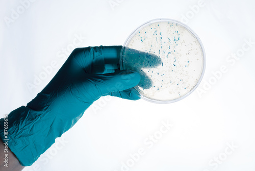 colonies  in petri dish for cloning of transgenic vector into plasmid DNA photo