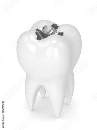 Obraz na plátně 3d render of tooth with dental amalgam filling