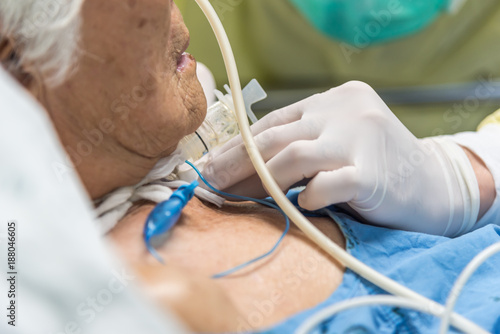 Patient do tracheostomy and ventilator in hospital