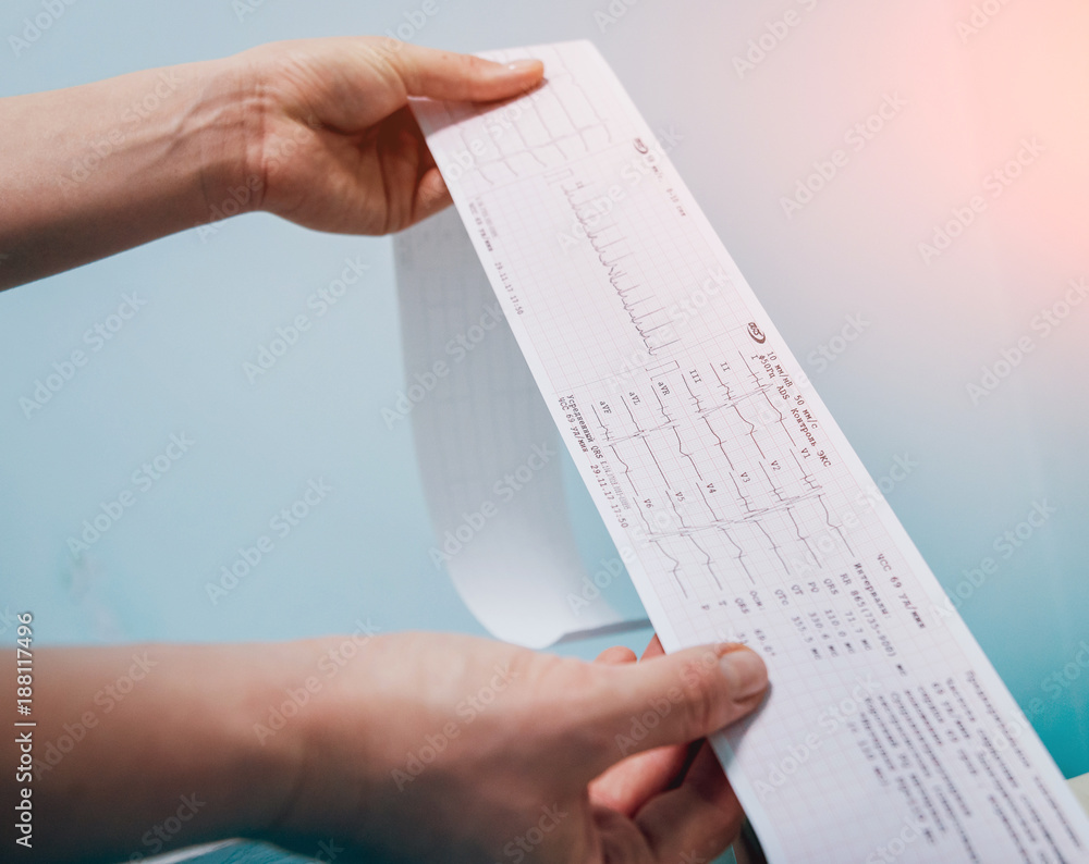 Fototapeta premium Doctor with electrocardiogram equipment making cardiogram test