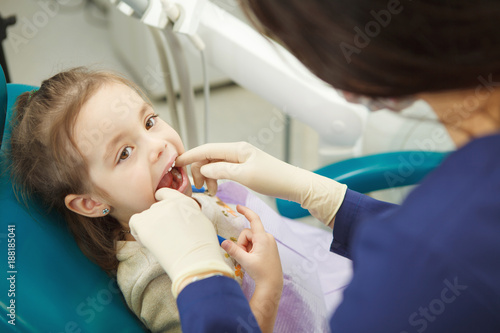 Dentist in rubber gloves checks mouth of child