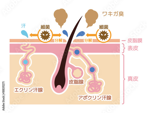 ワキガ臭発生の原因イラスト (腋臭・わきが）/日本語・説明文なし