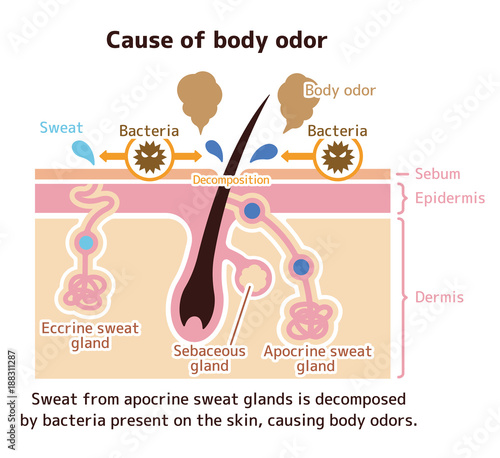 Cause of body odor illustration (English)  photo