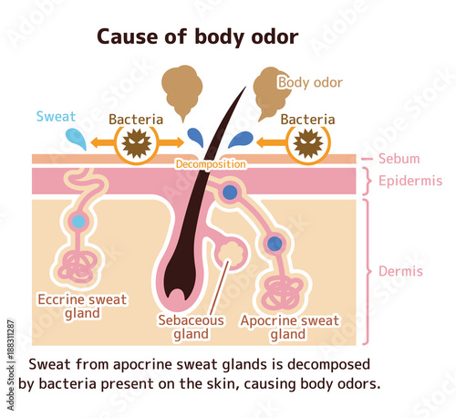 Cause of body odor illustration (English) 