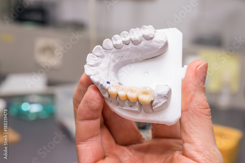Technical shots of model on a dental prothetic laboratory photo