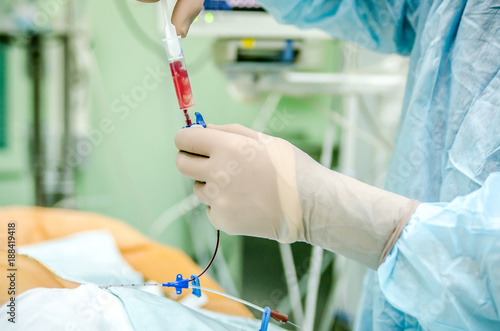 The process of checking the central venous catheter.
