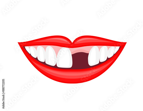Human mouth with missing tooth. Dental care concept. Illustration isolated on white background.