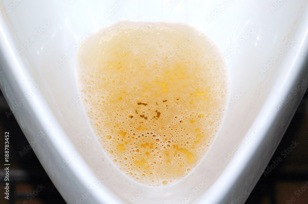Urine sample testing in a men restroom to be collected. Stock Photo ...