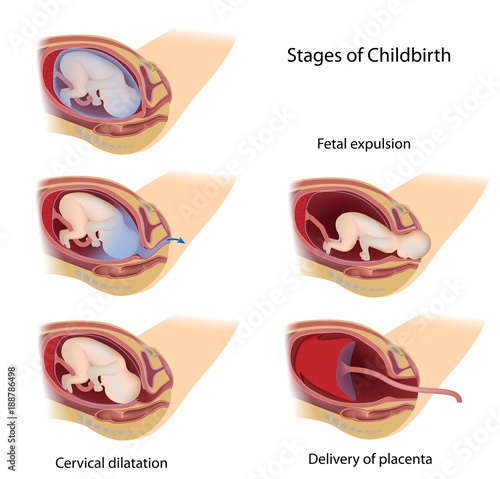 Fotografie Stages of Childbirth