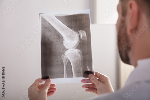 Doctor Holding Knee X-ray