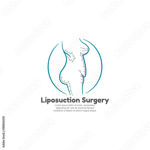 Template logo for liposuction surgery with human body