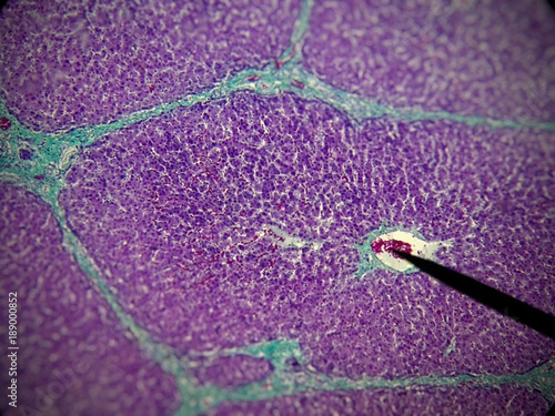 Canvastavla Health: Histological lamina of the pancreatic islets