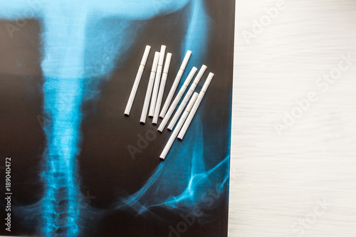 Принти на полотні X-ray of the lungs. concept fight with smoking