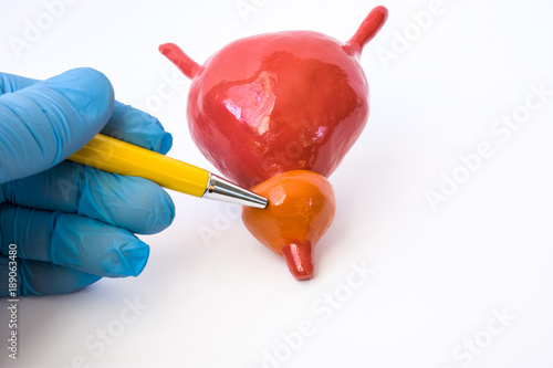 Doctor or teacher with ballpoint pen pointing on prostate gland on anatomical model of bladder with prostate. Study anatomy function of gland or indication for patient were detected prostate pathology