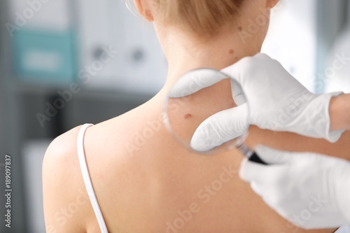 Foto Dermatologist examining birthmark of patient in clinic