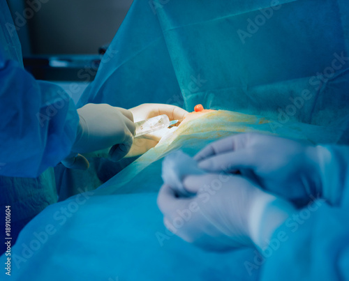 Breast surgery in the operating room.