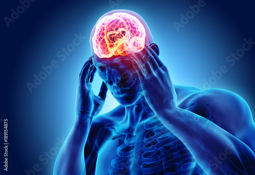 3d illustration of headache human. photo