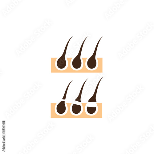 Diagram showing difference in methods of hair removal, flat style vector illustration isolated on white background. Side view diagram showing hairs removed by different methods